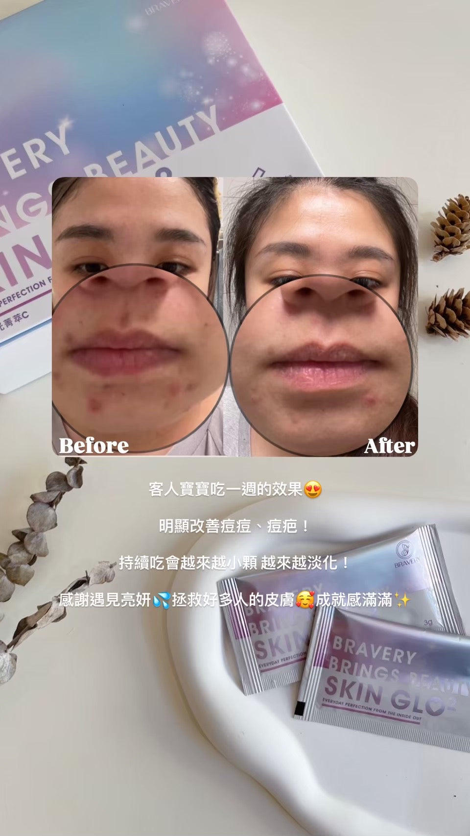 🥁 全新升級 | 亮妍時光菁萃Ｃ⁺PLUS⁺ 🦋